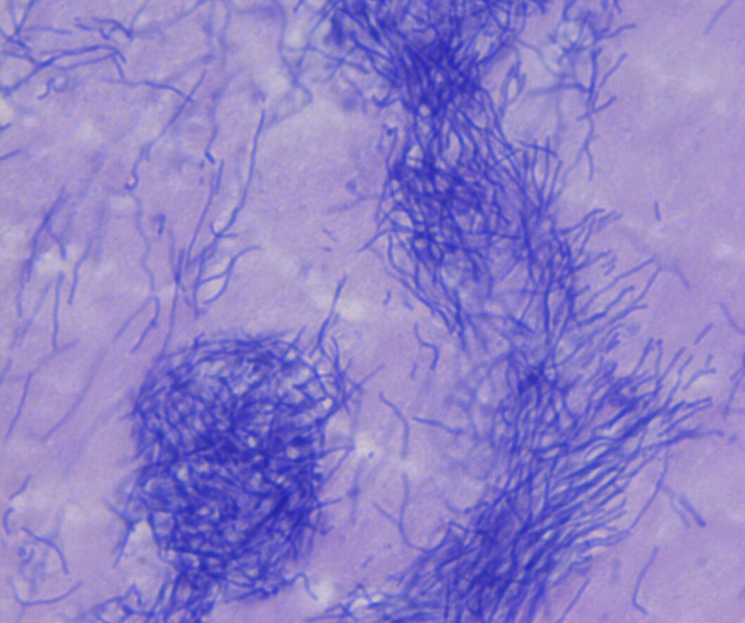 Bakterien på bildet er Tenacibaculum dicentrarchi  som har forårsaket sykdomsutbrudd hos smolt i landbasert sjøanlegg. Foto: Henning Sørum