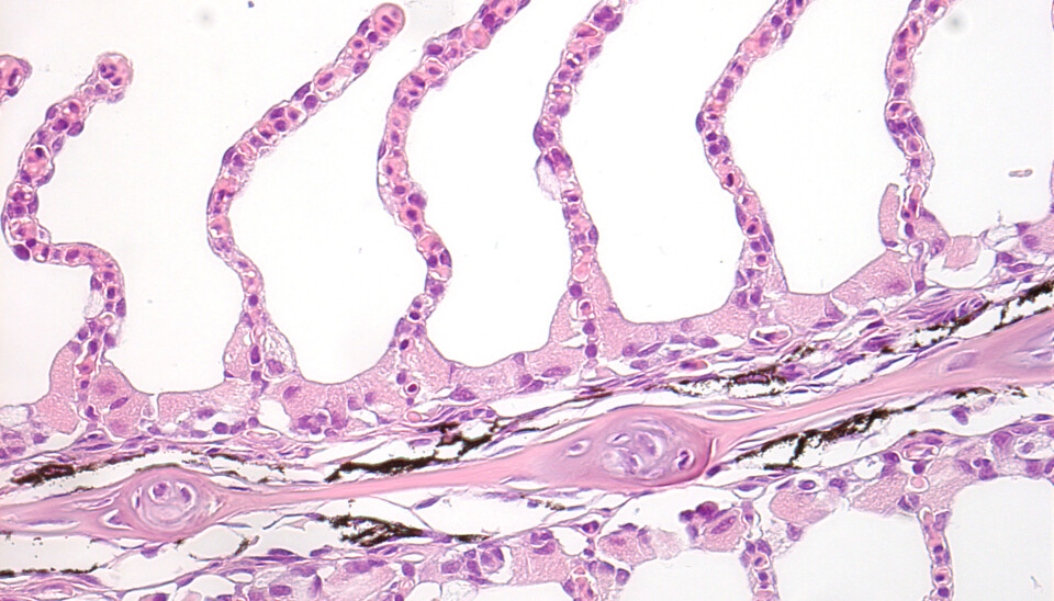 Histologi-bilde som viser tynne fine gjelle-lameller som sikrer kort vei mellom vann og blod slik at fisken lett kan ta opp det oksygenet den trenger. Histologi-bilde som viser tynne fine gjelle-lameller som sikrer kort vei mellom vann og blod slik at fisken lett kan ta opp det oksygenet den trenger.