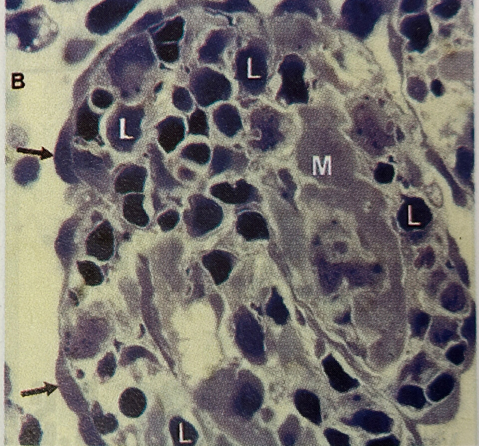 Figur B. Forkammerveggen i hjertet hos laks med akutt CMS. Legg merke til den store mengden med forsvarsceller (L) i muskellaget (M). Endotelceller (Pil). X500.