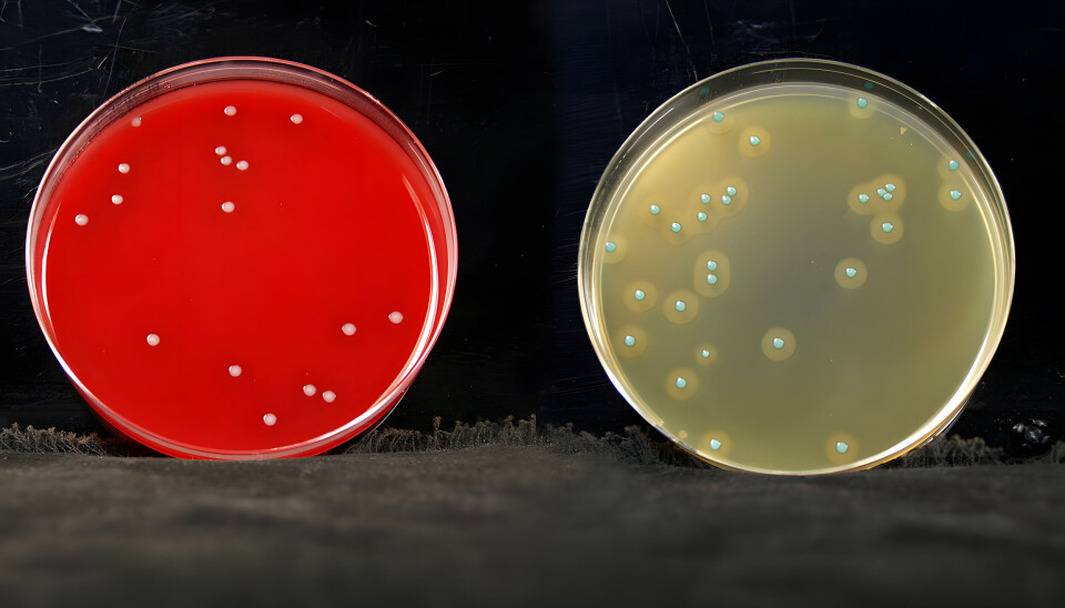 Slik ser Listeria-bakterien ut når den blir dyrket i laboratoriet. Den røde skålen er blodagar, som er et generelt dyrkingsmedium. Den lyse skålen er ALOA agar, som er et selektivt medium for Listeria. L. monocytogenes dyrket i ALOA-agar gir blakkede soner rundt kolonien. Andre Listeria-stammer som også kan finnes i produksjonsmiljøet, som for eksempel den ikke-sykdomfremkallende Listeria innocua, danner ikke soner. Det er dette mediet som benyttes i ISO metoden.