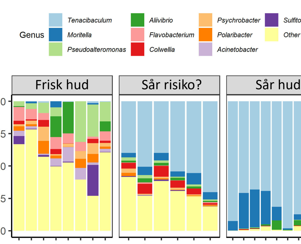 NGS og Mikrobiell Samfunnsanalyse: Hva er det?