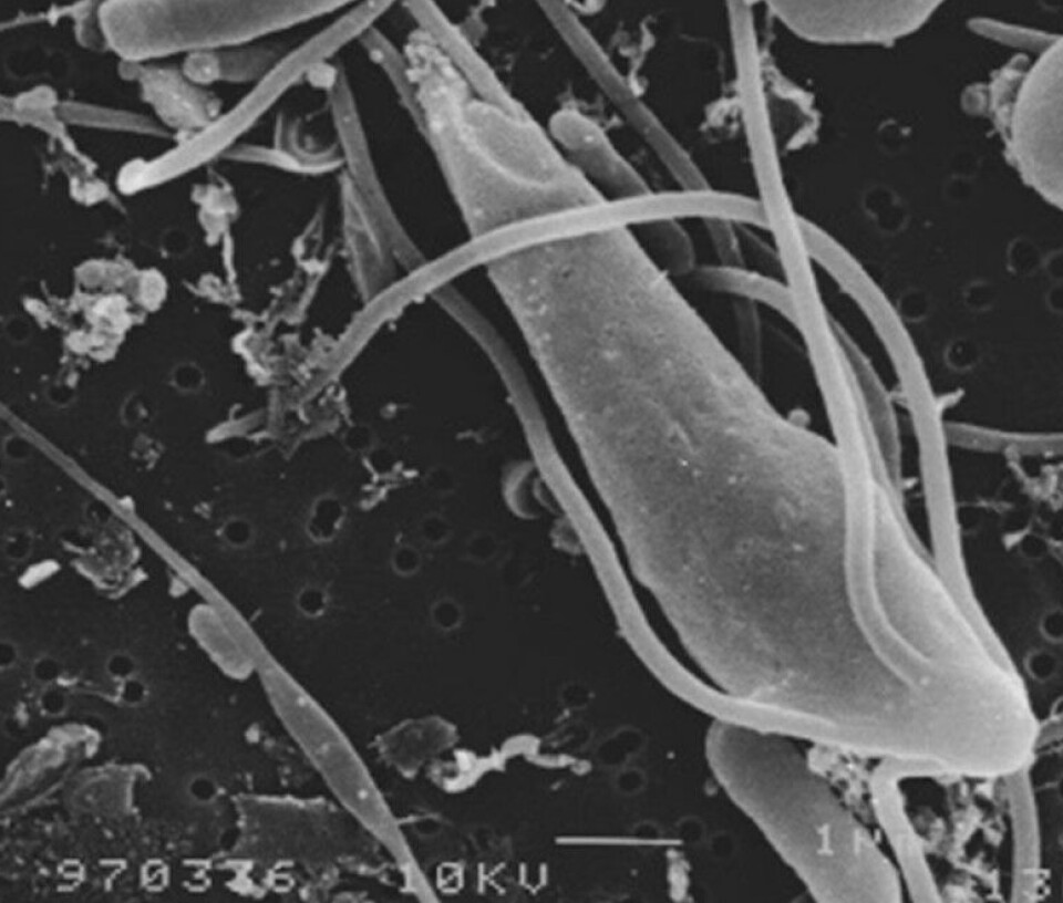 Figur 6 Scanningelektronmikroskopibilde av Spironucleus torosus fra torskefisken lake (i ferskvann).