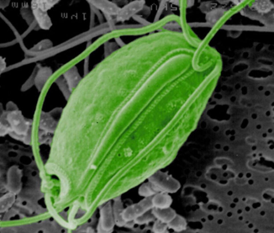 Figur 7. Fargelagt Scanningelektronmikroskopibilde av Spironucleus vortens fra karpefisken vederbuk.