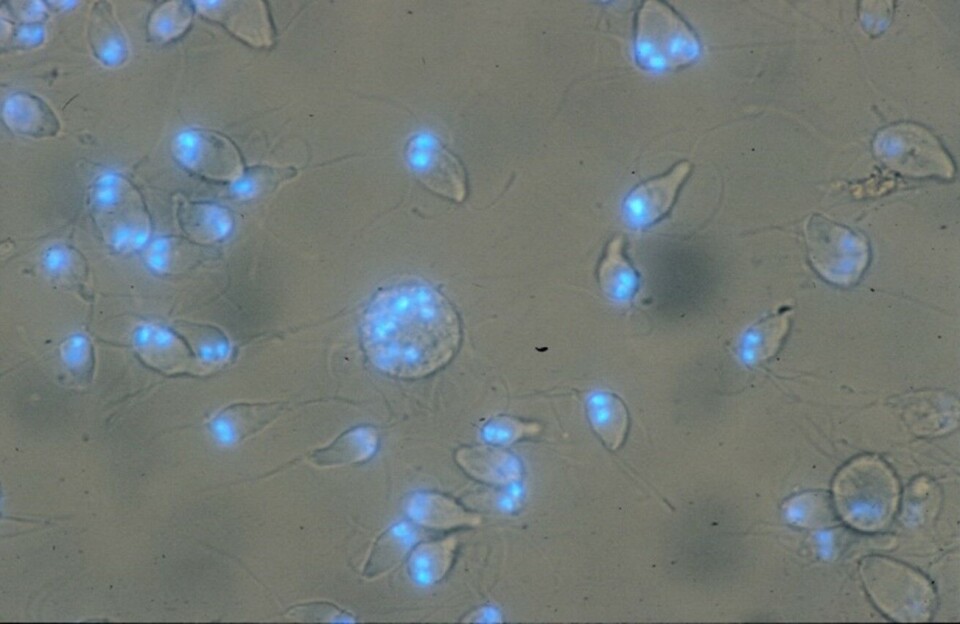 Figur 3. Lysmikroskopibilde av levende Spironucleus salmonicida med fargede kjerner. Man ser enkle flagellater og flagellater under deling (med 4 kjerner). Cellen med mange kjerner midt på bildet er antakelig resultatet av en mislykket celledeling, siden dette er fra en cellekultur.