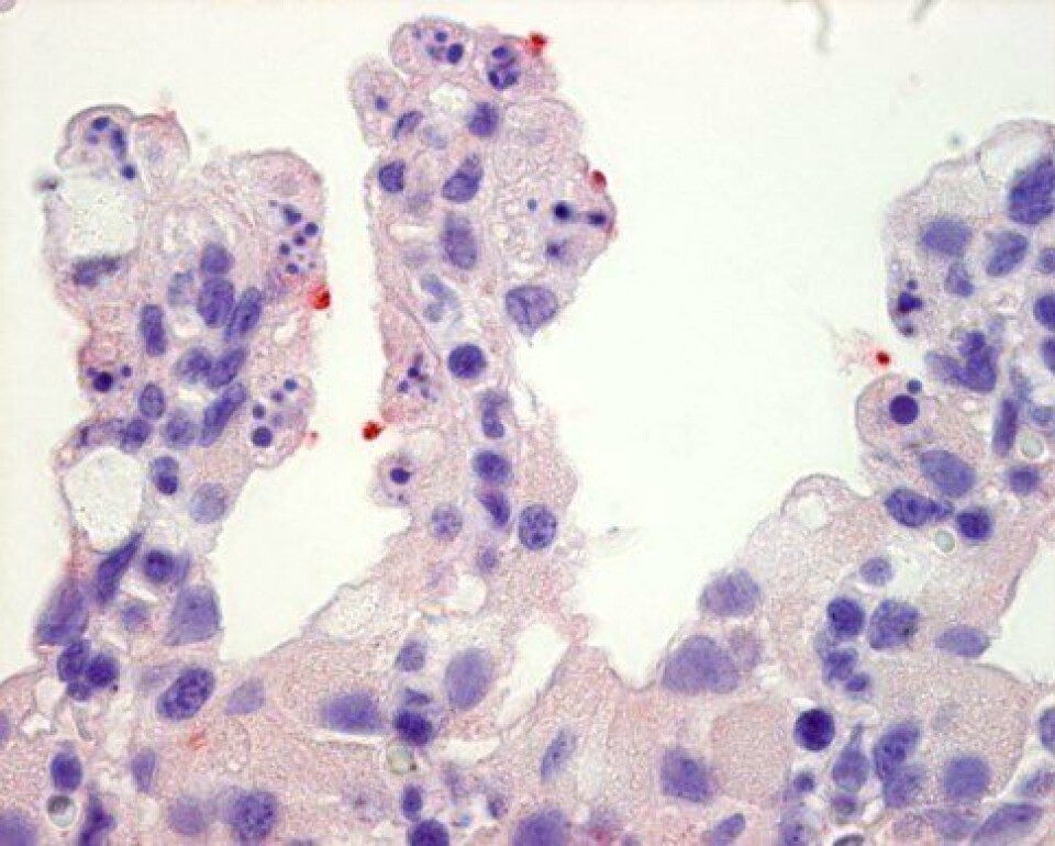 Poxviurs fra gjelle hos laks.Rød merking av poxvirus i syke gjeller