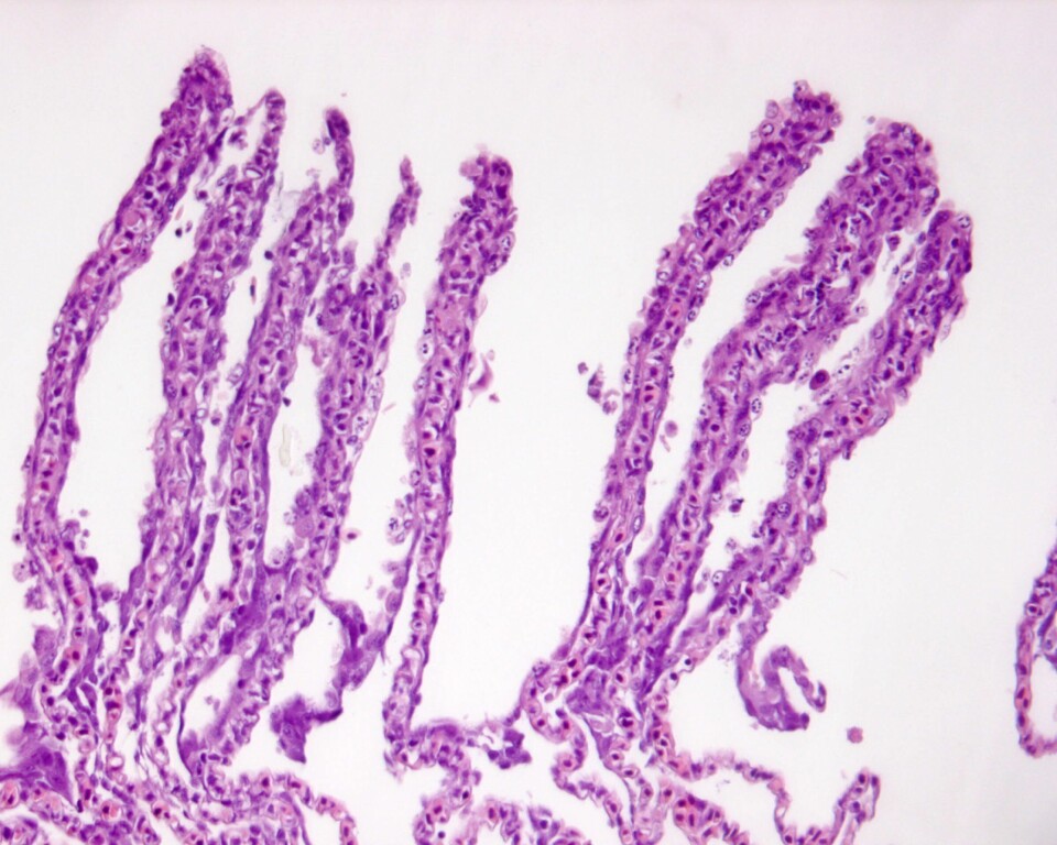 Histologisk snitt fra vill laks infisert med laksepox. Bildet viser gjellevev med fortykkede respiratoriske enheter med celler som er i ferd med å dø (infisert med laksepox). Foto: Mona Gjessing/Veterinærinstituttet.