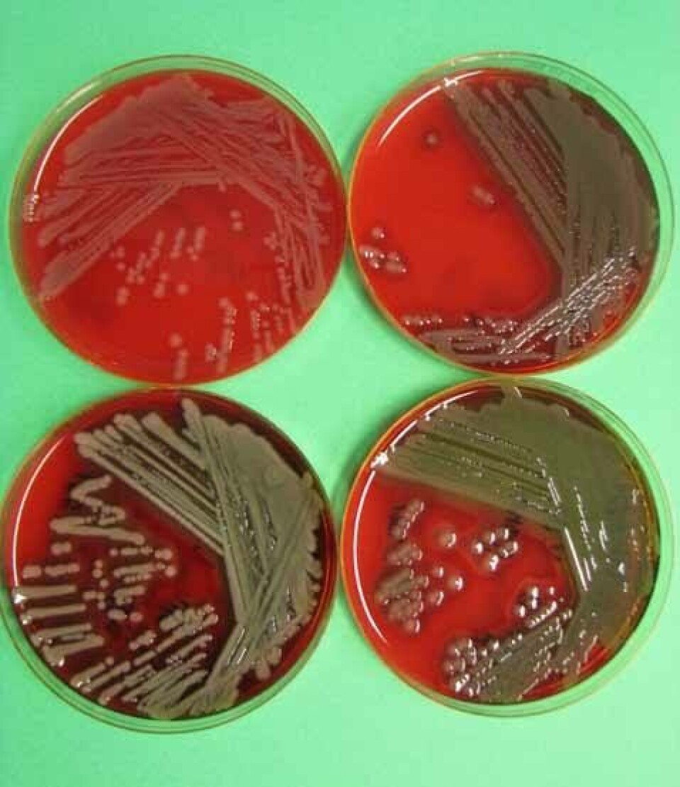 Vibrio spp isolert fra leppfisk. Foto Hanne Nilsen. Vibrio spp isolert fra leppfisk. Foto Hanne Nilsen.