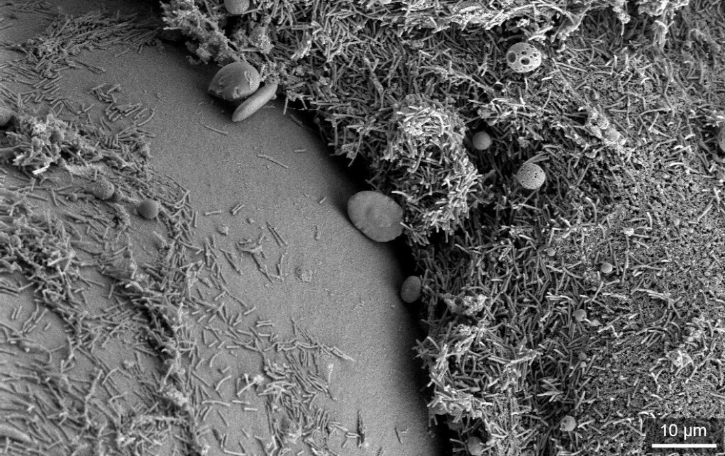 Elektronmikroskopisk bilde av Tenacibaculum marinum fra tann og tannkjøtt på laks. Foto: Kathleen Frish.