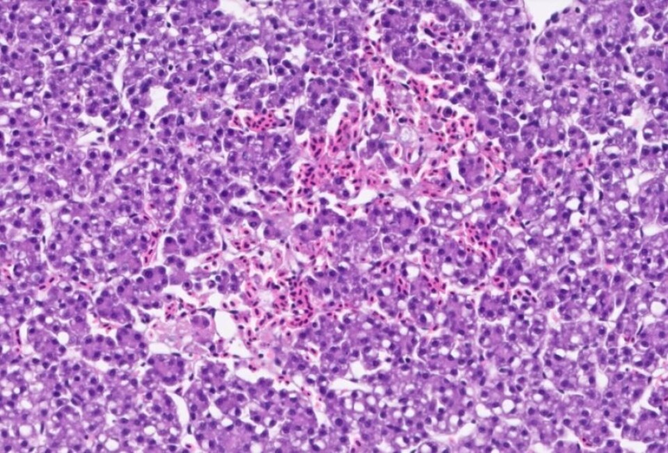 Bildet viser lever med nekrose og blødninger hos fisk fra anlegg med mulig algetoksin Foto: Pharmaq Analytiq.