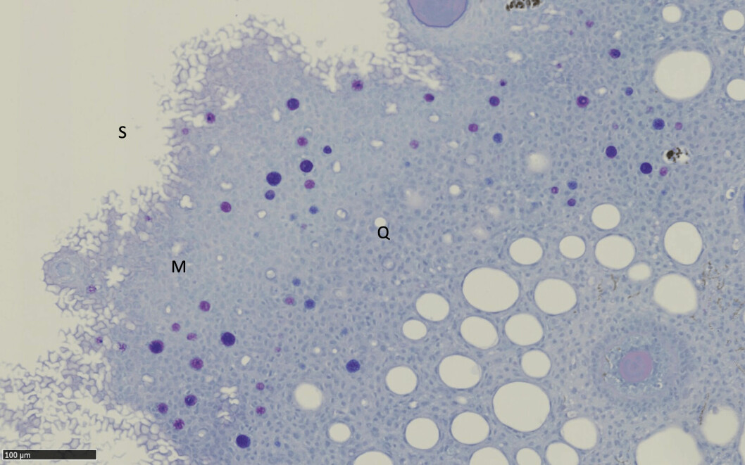 Tverrsnitt av hud hos rognkjeks med slimceller (små celler, farget mørkeblå, M) og Q-celler (store celler, farget hvit-lyseblå) samt frynsete overflate celler (S).