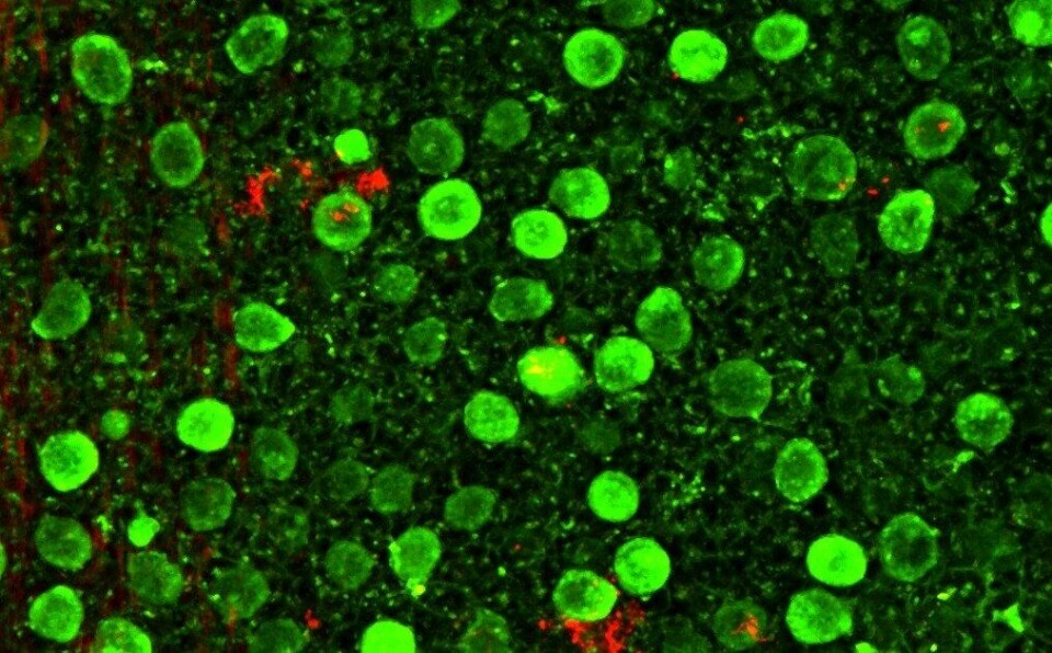 Intakt lakseskinn fotografert med konfokalmikroskop, hvor vi ser fra overflaten og innover i vevet. De sterkt lysende grønne ballene er slimceller. Svakere grønnfarge viser cellemembraner og rød farge er glycoproteiner. Foto: Aquagen.