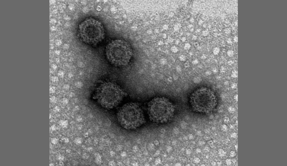 En studie fra NMBU Veterinærhøgskolen viser at ulike varianter av det utbredte viruset PRV (Piscint orthoreovirus) har ulik evne til å fremkalle HSMB (hjerte- og skjellettmuskelbetennelse) hos laks. Denne nye kunnskapen kan bidra til at det i fremtiden vil bli mulig å sette inn målrettede tiltak mot de virus-variantene som gir mest sykdom. Dette kan bli en viktig og effektiv strategi i fremtiden for å redusere sykdom knyttet til HSMB i norsk fiskeoppdrett. Bildet er et elektronmikroskopi av PRV-viruset. Foto Øystein Wessel/NMBU Veterinærhøgskolen