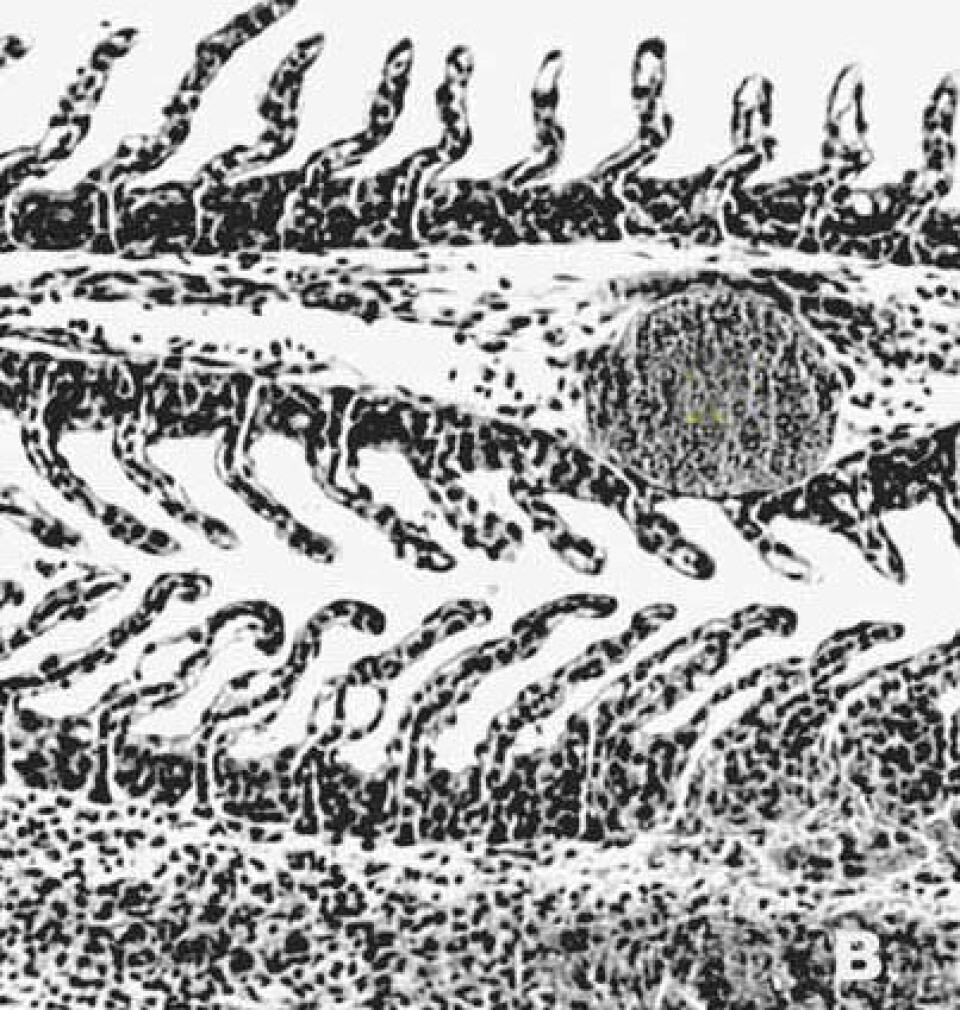 Mikrosporidie